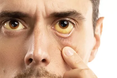 Какое эволюционное преимущество дает человеку белая склера глаза? |  Популярная наука | Дзен