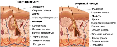 Лишай у человека | симптомы, причины и лечение