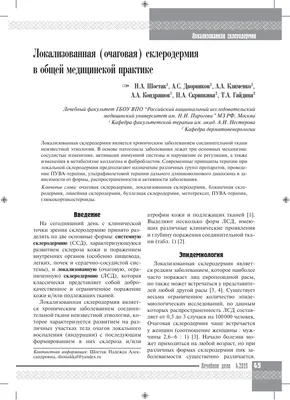 Склеродермия (системная) - диагностика и лечение в Москве. Консультация  врача.