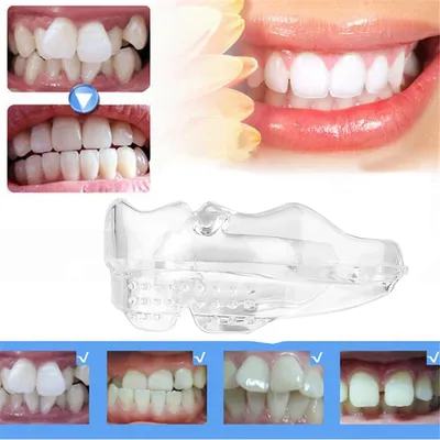 1 шт., ортодонтические скобы для выравнивания зубов | AliExpress