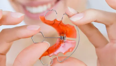 Ортодонтические пластинки и аппараты - съемные пластинки взрослым и детям.