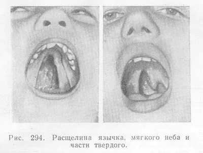 Региональные методические рекомендации по диагностике и лечению аси