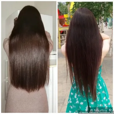 Есть ли жизнь после выпадения длинных волос: новая стрижка и цели,  восстановление густоты, фото до и после в разный период