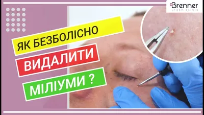 Лечение фотодерматита (аллергии на солнце) в Киеве | Brenner Clinic