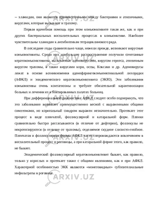 Конъюнктивит: лечение и диагностика, причины и симптомы заболевания у  взрослых, осложнения и последствия