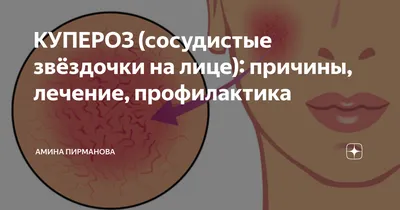 Онколог рассказал, опасно ли появление на теле красных родинок - Российская  газета