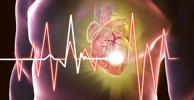 Ишемическая болезнь сердца — что это, причины, симптомы, лечение | Блог |  Complimed