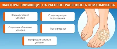 Грибок ногтей на ногах | Лечение онихомикоза под ногтем