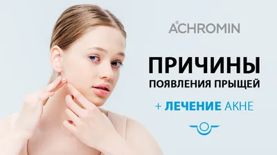 Как Акне Случаются Стадии Акне Клипарты, SVG, векторы, и Набор Иллюстраций  Без Оплаты Отчислений. Image 53504421