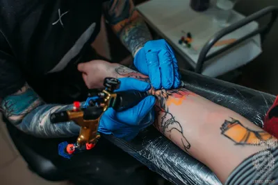 Как и чем удалить татуировку, все об удалении тату