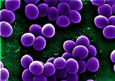Бактерии Метициллин-устойчивый Золотистый Стафилококк MRSA, Множественной  Лекарственной Устойчивостью Бактерий На Поверхности Кожи Или Слизистой  Оболочки, 3D Иллюстрации Фотография, картинки, изображения и  сток-фотография без роялти. Image 76045267