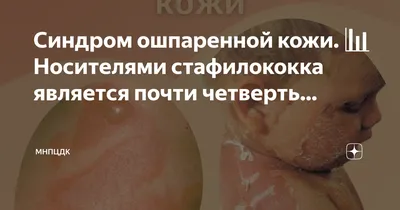 На коже каждого из нас живет смертельно опасная бактерия » Новости Беларуси  - последние новости на сегодня - UDF