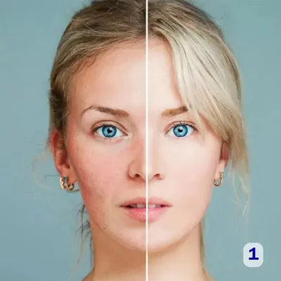 Способы и эффективные процедуры, чтобы замедлить старение кожи лица ➤  Публикация ⭐ Косметологической Клиники BeautyMED