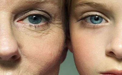 Что влияет на старение кожи и как этого избежать