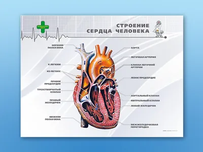 Стентирование сосудов сердца: коронарное стентирование в Одессе|  Медицинский дом Odrex
