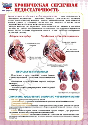 Стенд \"Ишемическая болезнь сердца ее симптомы и профилактика\"