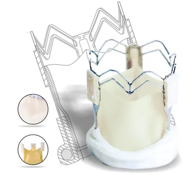 Microporous surface as a new solution for stent surface modification: A  review - Kamolov - Consilium Medicum