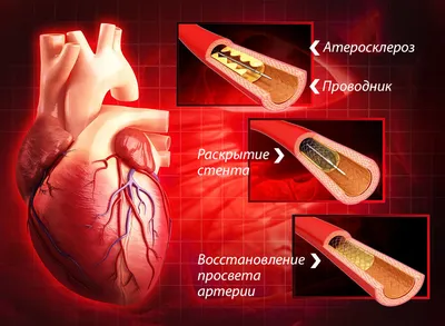 Кардиология в Алматы. Диагностика и лечение. Спирометрия - Медцентр CARDIOS