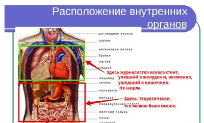 💙 󾬓 Стентирование сердца 💙 󾬓 Стентирование сосудов сердца в Запорожье