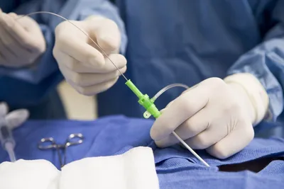 Операция стентирования сосудов сердца – методика, осложнения, реабилитация  — клиника «Добробут»