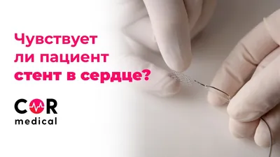 Чувствует ли пациент стент в сердце? - YouTube