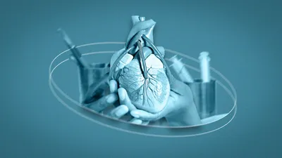 Трехмерная модель поможет спрогнозировать рецидивы ишемии сердца после  установки стента | CoLab