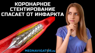 Стентирование сосудов сердца: коронарное стентирование в Одессе|  Медицинский дом Odrex