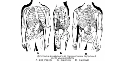 Спина ПАМЯТКА