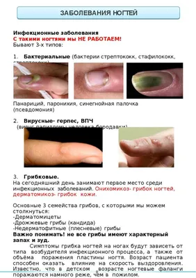 Streptococcus pyogenes — Википедия