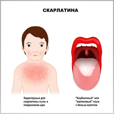 Пятно на ноге, не проходит: причины и методы лечения