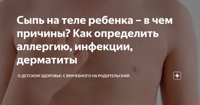 Обнаружение стафилококка и стрептококка: симптомы и методы лечения