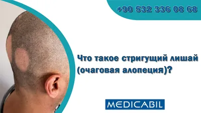 Микросп... - Центр диагностики кожи Клиника доктора Андрейчева | Facebook