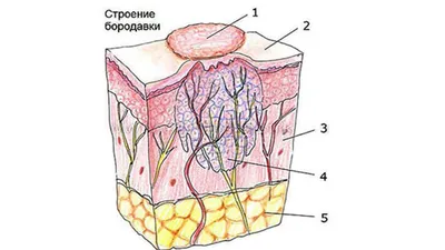 Бородавки – Dr.Nona