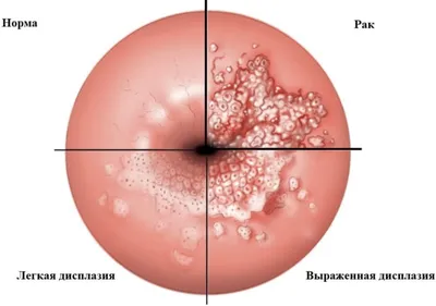 Кто вы, мистер ВПЧ? | ВКонтакте