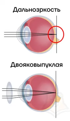 Анатомия: Орган зрения, organum visus. Глаз. Глаза.