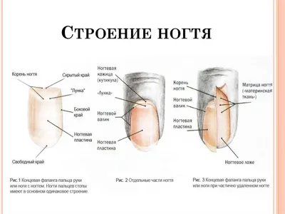 Удаление вросшего ногтя - лечение онихокриптоза, лазерное или радиоволновое  удаление