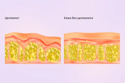 Новообразования на коже - классификация | читать cтатью ☕