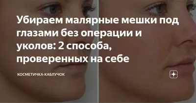 Ответ пользователю @elmira_0803 как убрать малярные мешки/суфы #малярн... |  TikTok