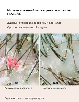 Сухая кожа. С чем это связано, и как за ней ухаживать