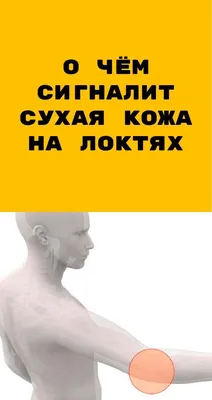 Ихтиоз: что это за болезнь кожи, лечение симптомы, причины, виды