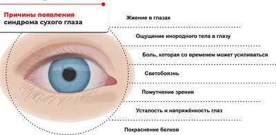 Синдром сухого глаза: как лечить? - YouTube