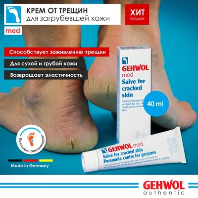 Церадерм Крем для ног восстанавливающий для сухой кожи 75мл цена от 307  руб. купить в аптеках Апрель, инструкция по применению