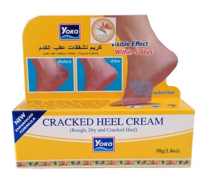 Balea Hornhaut Reduzier creme