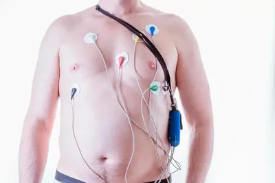 Суточное мониторирование ЭКГ по Холтеру – сеть кардиоцентров МЕДИКА