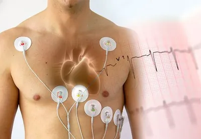 Холтер диагностика в Зеленограде в КДЦ 24