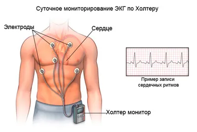 Суточное мониторирование ЭКГ по Холтеру - цена холтеровского суточного  мониторинга ЭКГ в СПб