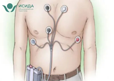 Холтеровское мониторирование: описание процедуры, показания