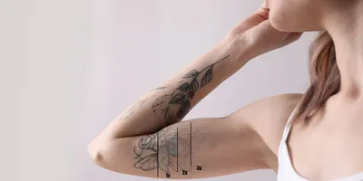 Удаление татуажа и татуировок | Студия эпиляции и косметологии