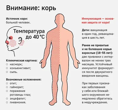 Об эпидемиологической ситуации по кори