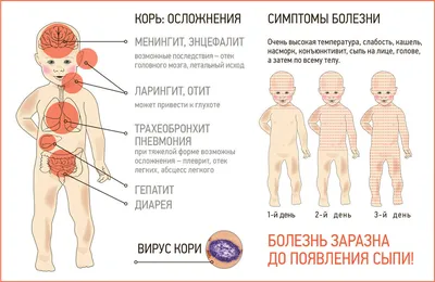 Симптомы и лечение кори у детей | Добромед